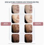 EucerinAntipigmentCremaFacialDiaFPS3050mL