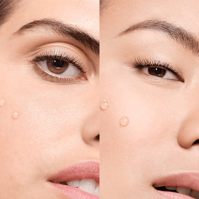 Vichy Normaderm Probio-BHA Serum 30 mL